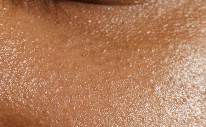 por qué se agrandan los poros de la piel 