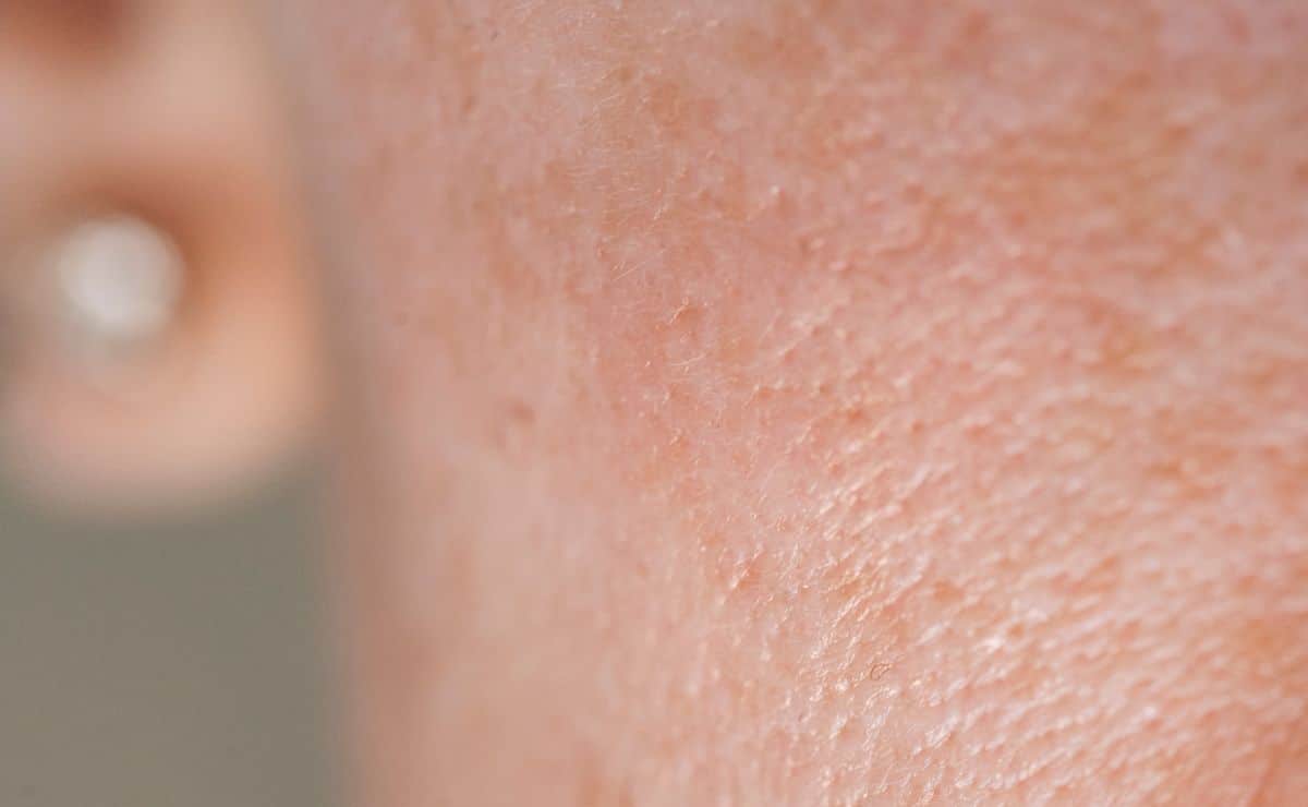 minimizar los poros de la piel